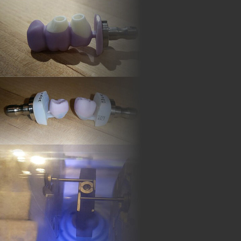 Cad Cam – Zahnarztpraxis Naturalsmile M. Wojtunik & Kollegen Pfronten