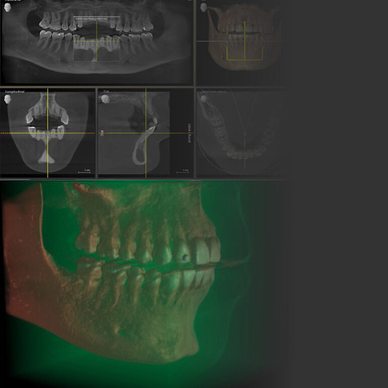 3d Diagnostik – Zahnarztpraxis Naturalsmile M. Wojtunik & Kollegen Pfronten